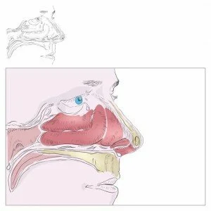 rhinitis1