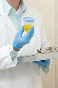 urine sample